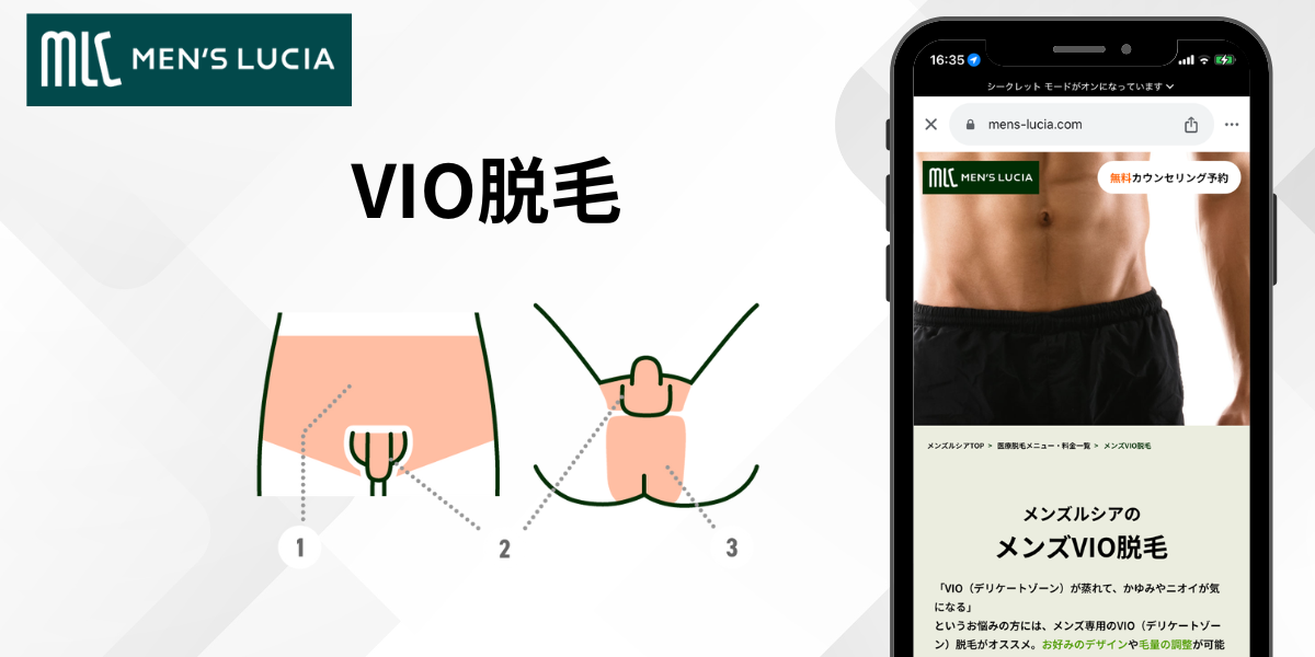 メンズルシアVIO脱毛