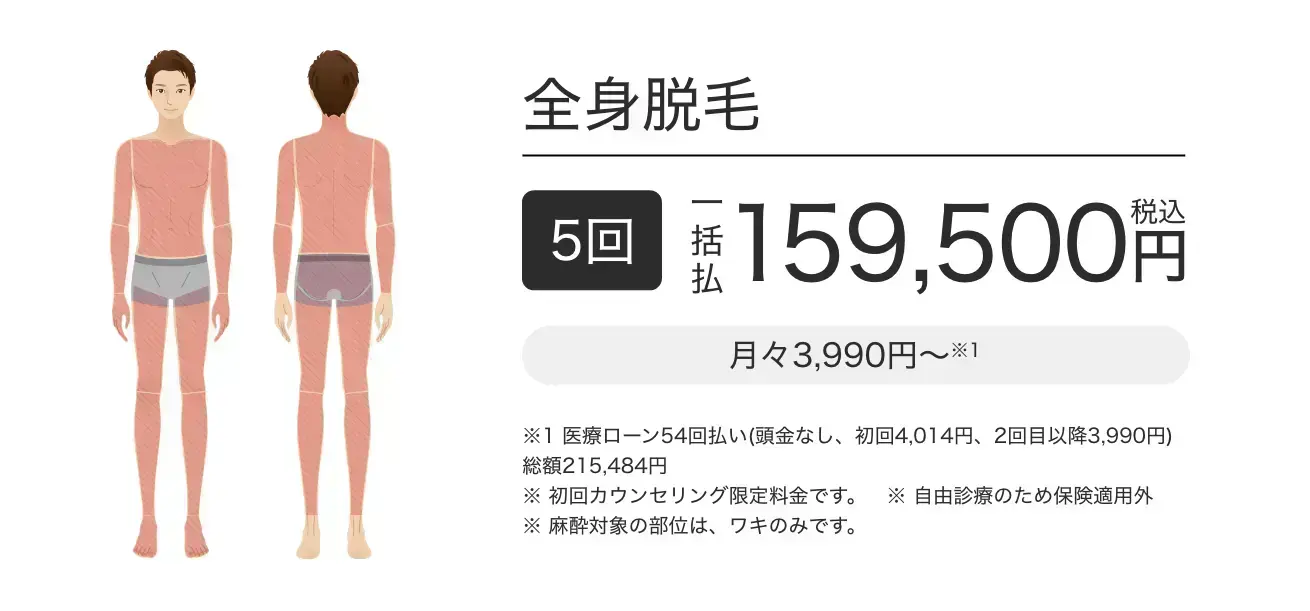 メンズエミナル全身脱毛の料金