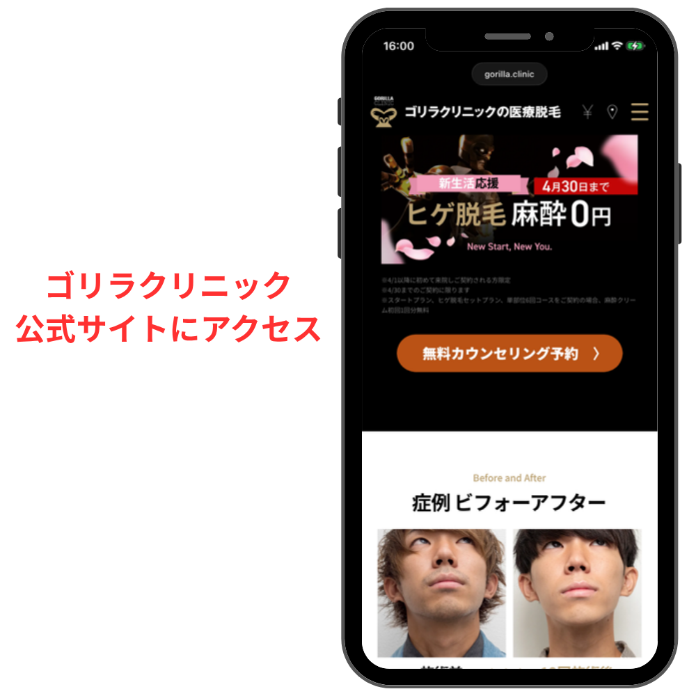 ゴリラクリニック予約
