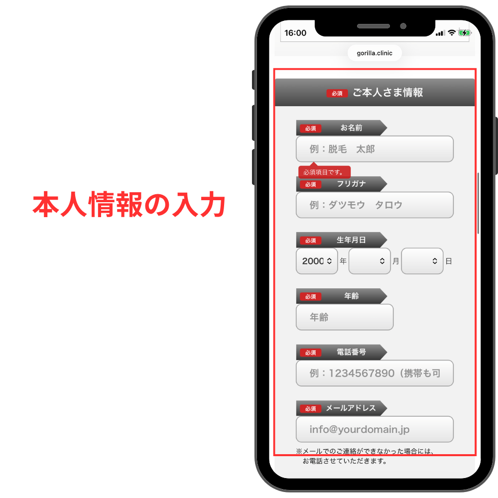 ゴリラクリニック予約